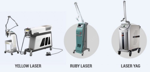 Công nghệ trị nám yellow laser advanced là công nghệ trị nám hiệu quả nhất hiện nay