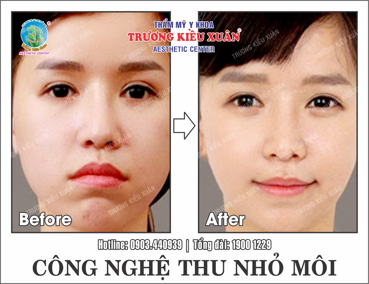 thu nho moi (truoc-sau)