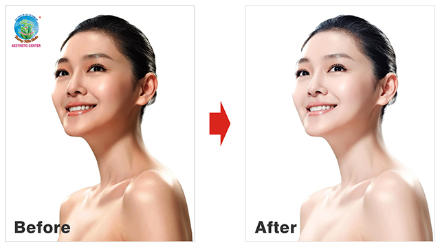 Tắm trắng tại spa