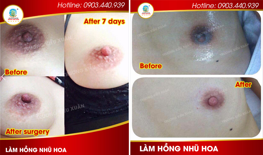 LAM HONG NHU HOA